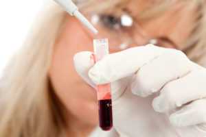 Методика измерений гликированного гемоглобина
