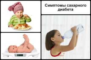 Симптоматика сахарного диабета у детей