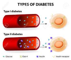 1 и 2 типы диабета