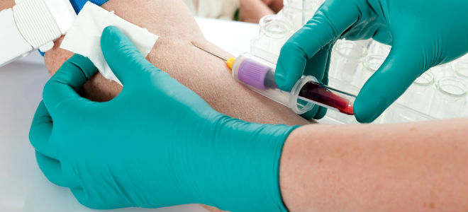Зачем нужен биохимический анализ крови при заболевании панкреатит