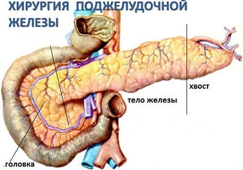 схема поджелудочной железы