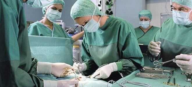 Хирургия при хроническом панкреатите: показания к операциям и виды операций