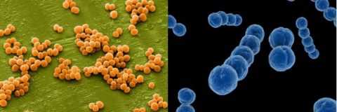 Частыми возбудителями баланопостита выступают бактерии стафилококка и стрептококка.