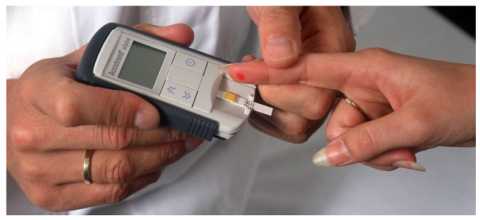 Делайте анализ глюкозы в крови натощак. Показатель более 7 ммоль/л – наличие СД