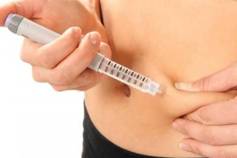 Инъекции инсулина обязательно требуются при СД I типа.