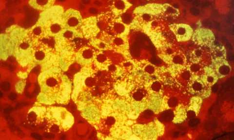 Микрофото бета-клеток поджелудочной железы – основного источника синтеза инсулина
