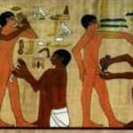 Обрезание и лечение полового органа у мужчин проводят еще со времен Древнего Египта